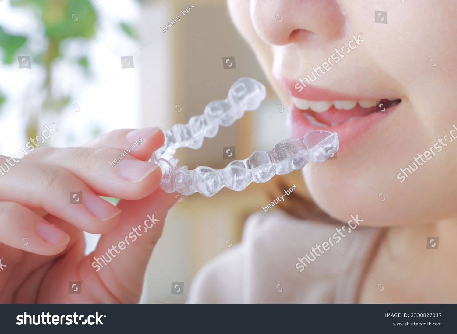 Dental night guard illustration