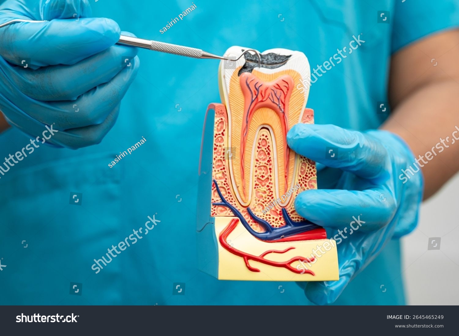 Root canal therapy at Bloomingdale